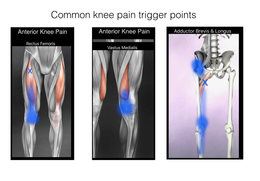 Quick Fix For Knee Pain The Kelsey Report